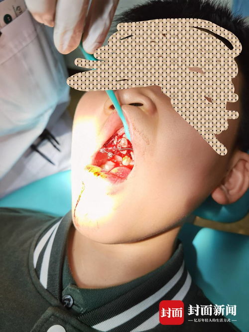 重慶特斯拉車主遭遇驚魂一幕 停車時車輛自動加速撞墻，致孩子受傷